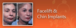Face and Chin Implants