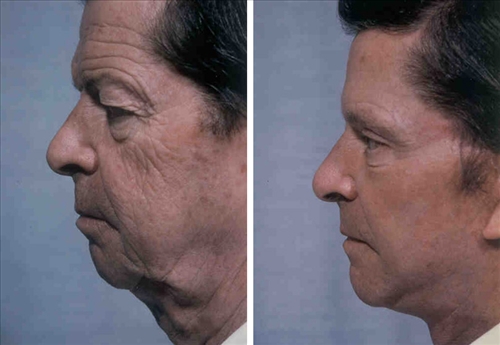 faceandneck25.jpg