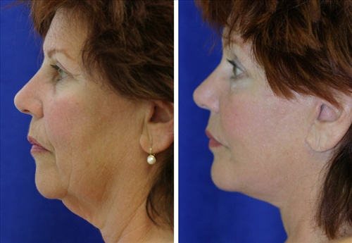 face and neck image 9