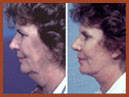 face and neck small image 11