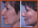 face and neck img 15