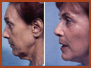 face and neck image 16