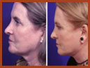 face and neck image 17