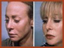 face and neck 20a img