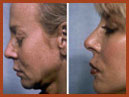 face and neck image 21