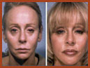 face and neck image 22