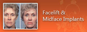 Face lift Midface implants