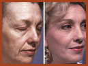 face and neck 20a img