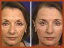 face and neck image 1