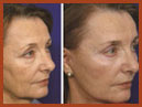 face and neck image 1