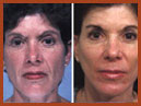 face and neck image 6
