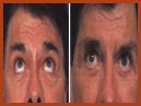 midfacelift image 6